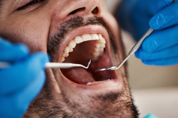 Best Emergency Gum Treatment in Eldridge, IA
