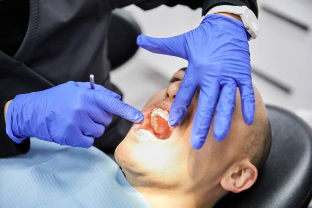 Best Urgent Care for Lost Fillings or Crowns in Eldridge, IA
